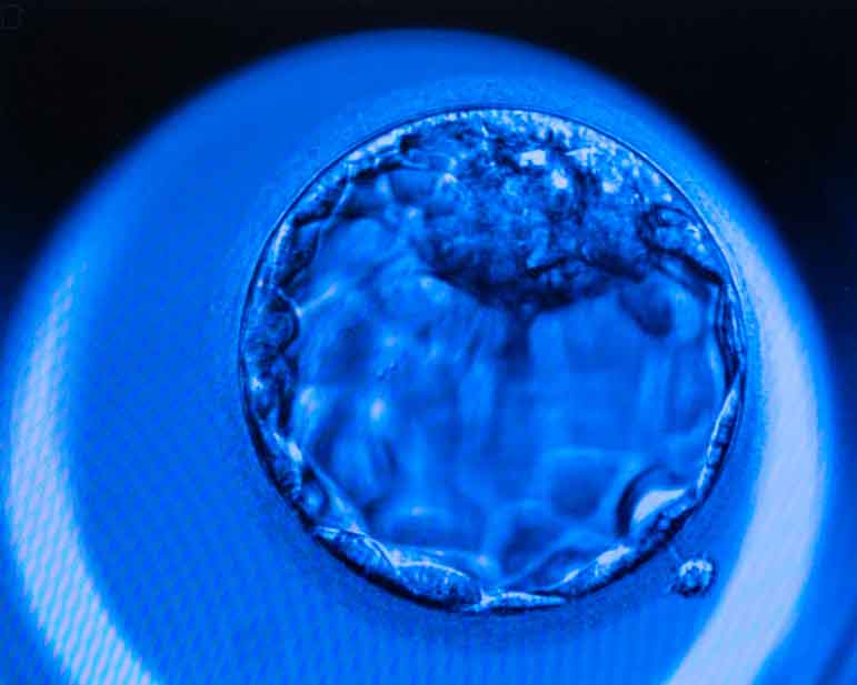 Overturn of Roe could make IVF more complicated, costly
	
	