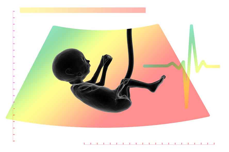 Ultrasound: The Anti-Science Left's Bugaboo


